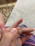 Пятно на пальце руки у ребенка фото 3