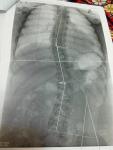 Вред рентгеновского излучения фото 1