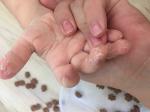 Ребёнку 3,3 года сходит кожа на пальцах рук и ног фото 4