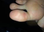 Палец большой ноги фото 1