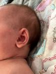 Акне новорождённого или аллергия? фото 3