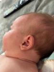 Акне новорождённого или аллергия? фото 1