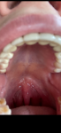 На язычке горла дополнительная ткань фото 3