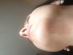 Зуд половых губ сопровождается появлением пятна на лице фото 1