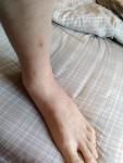 Травма ноги фото 1