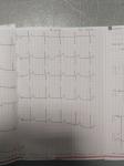Проверка сердца, расшифровка ЭКГ фото 2