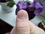 Укорочение ногтя, трещины на коже у ногтя фото 2