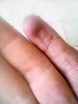 Высох палец после раны фото 1