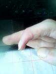 Высох палец после раны фото 3