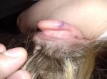 Ребенок ударился ушной раковиной фото 1