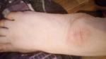 Пигментное пятно на ноге, грубая кожа фото 1