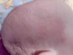 Сыпь у младенца внезапная фото 1