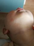Сыпь на животе и подбородке у ребенка фото 2