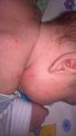 Сыпь по телу малыша фото 1