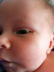 Гноится глаз у новорожденного на фоне капель, + мелкие вопросы фото 2