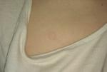 Странные розо-бежевые пятна на груди и спине фото 1