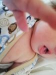 Пятно на груди у новорождённого фото 1