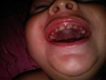 Рушаться зубы у ребенка фото 2