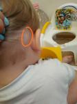 Уплотнение за ухом у ребенка фото 1