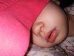 У ребенка 1год и 4 месяца появились красные пятнышки под носом фото 2