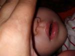 У ребенка 1год и 4 месяца появились красные пятнышки под носом фото 1