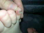Красный болезненный палец фото 1