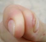 Ногти болят под ногтями фото 1