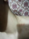 Красные пятна, в области груди шеи живота, небольшой зуд фото 3