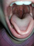 Заложенности носа, пупырья на горле и гнилистый запах фото 2
