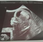 Беременность 12 недель 2 дня фото 1