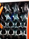 Расшифровать МРТ мягких тканей шеи фото 4