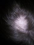 Облысение, сечение волос фото 1