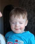 Неппоходящие высыпания на лице ребенка 11 месяцев фото 2