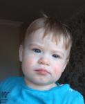 Неппоходящие высыпания на лице ребенка 11 месяцев фото 1