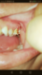 Боль зубная беременность 2триместр фото 2