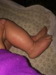 Желушение, и трещины на ножках у младенца фото 1