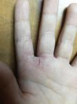 Изменение кожи рук у ребёнка фото 3