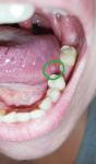 Воспаление языка и горла фото 4