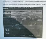 Дисплазия тазобедренного сустава лёгкой степени слева фото 2
