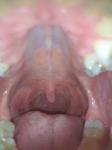 Першение в горле, сухой кашель фото 1