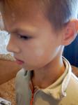 Белое пятно на щеке у ребенка 10 лет фото 1