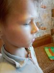 Белое пятно на щеке у ребенка 10 лет фото 3