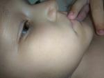 Белые пупырышки на лице у ребенка фото 2