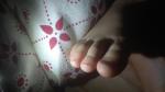 Пузырьки глубоко под кожей, красные полоски под ногтями у ребенка фото 2