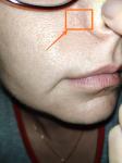 Что с крылом носа-аллергия? фото 1