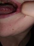 Першение в горле и болит язык сбоку фото 4