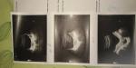 Ультразвуковое исследование органов малого таза фото 1