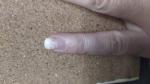Ногти, белые пятна фото 5
