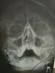 Рентген снимок пазух носа фото 1