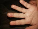 Опух палец руки фото 3